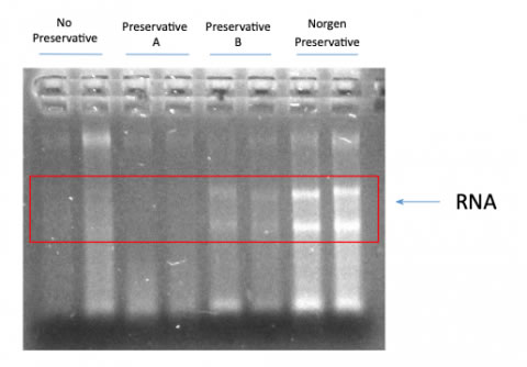 etoh swab