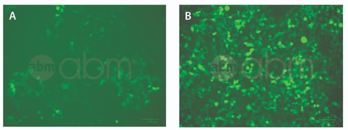 Aavviralentry Increases Transduction Efficiency
