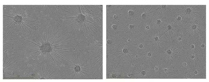 Axocells Phase Contrast Comparison Als