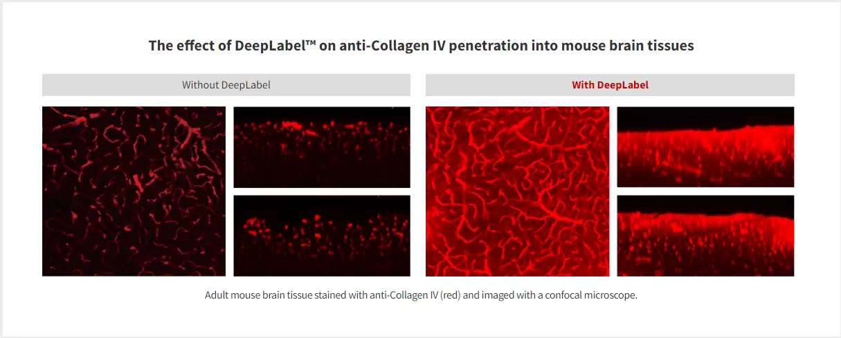 Logosbiosystems Deeplabel On Anti Collagen Iv Penetration Into Mouse Brain Tissues 02 Min