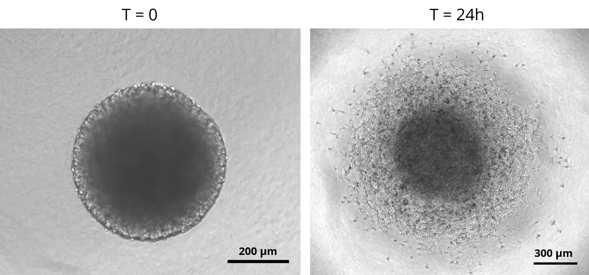 Spherotribe Fig Invasion Glioblastome Light